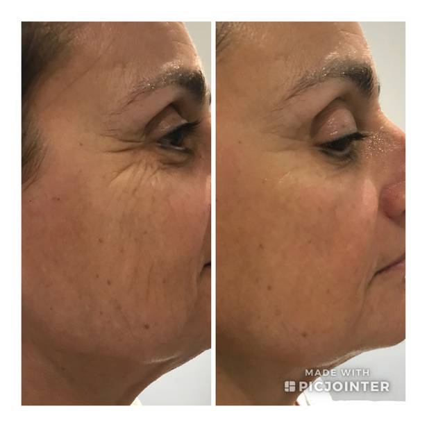 comparaison visage